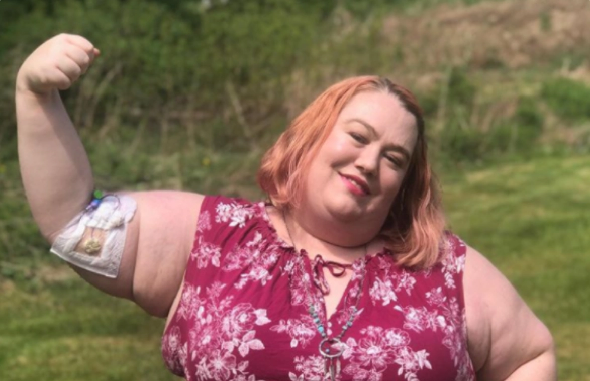 woman making a muscle proudly showing arm bandage
